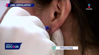¿Cómo se reconstruyen los lóbulos por el peso de los aretes | Visita de Doctor
