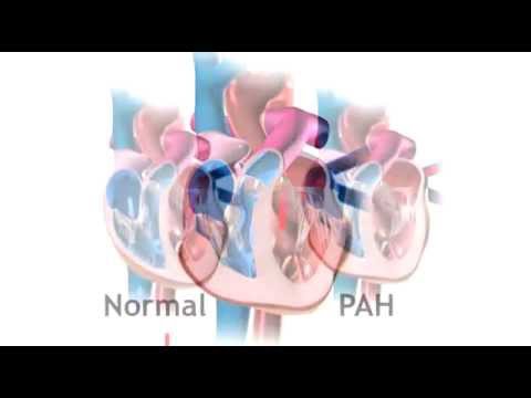 Bosentas 125 mg tablet