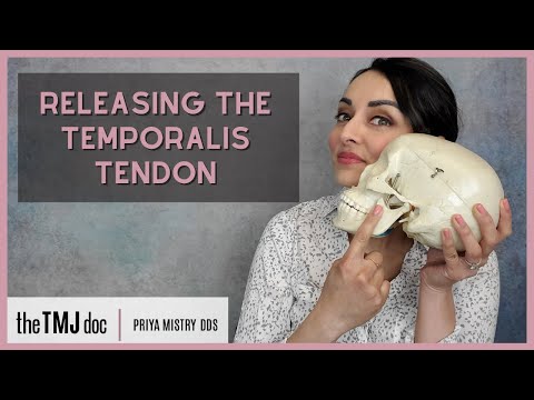 Releasing the Temporalis Tendon - Priya Mistry, DDS (the TMJ doc) #temporaltendonitis #tmjd #tmj