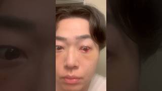 こーわ #整形 #コウちゃん #korean