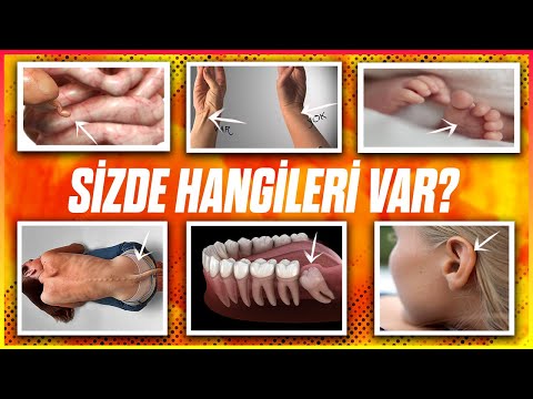 How Many of These Vestigial Organs Do You Have?