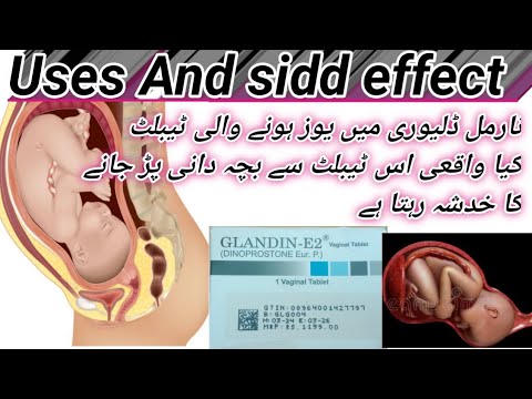 Tablet to be taken during normal delivery/Glandin E2 tab servix soft karne ke liye/Dinoprostone/urdu