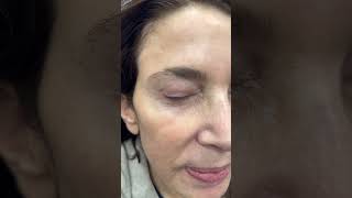 Flora Levin MD