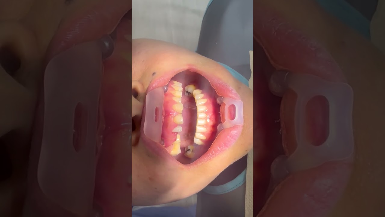 Melissa Gómez Arango-38