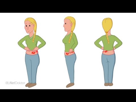 Gürtelrose: Entstehung und Tipps zur Vorbeugung - NetDoktor.de