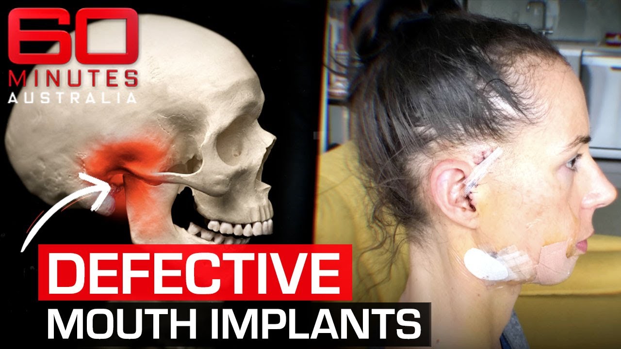 Jaw Trainers: Doctor Mike Warns of TMJ and Dental Damage from TikTok