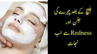 Tips for treating after bleach burns | how to get rid of face rashes on face after bleach |