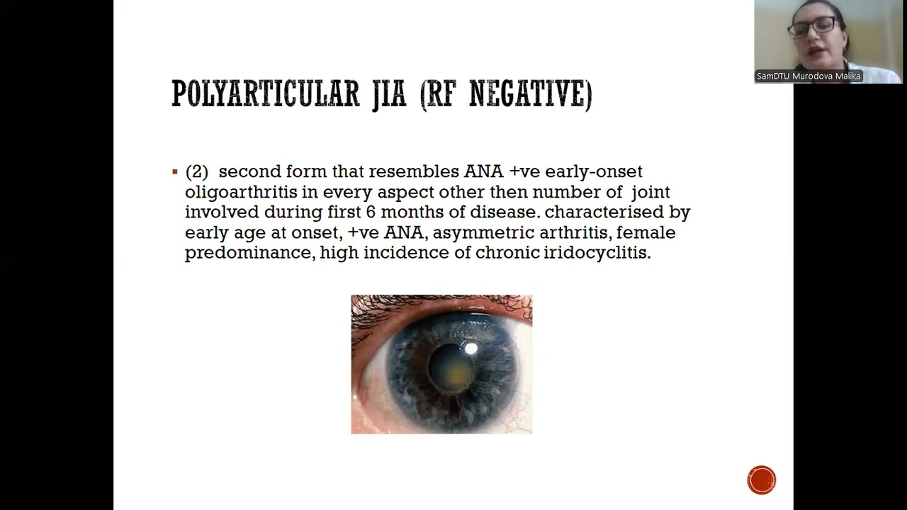 Juvenile idiopathic arthritis
