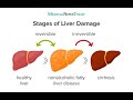 Fatty liver disease is on the rise.