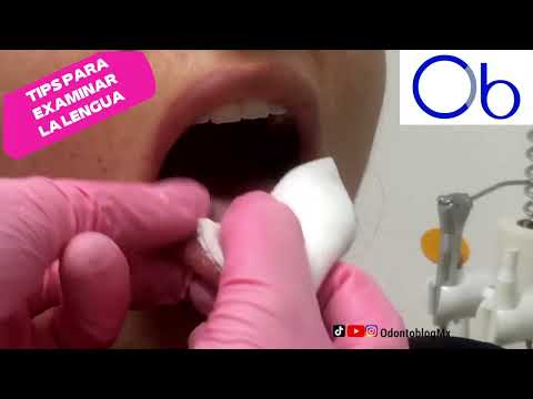 Así se examina la lengua 👅