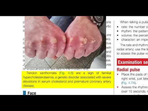 Macleod’s Cardiovascular Examination: A Deep Dive Part 1