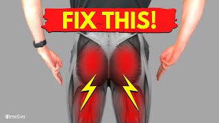 How to Relieve Sciatica Pain in BOTH LEGS
