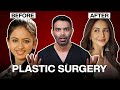 Rakul Preet Singh Before After Plastic Surgeon Reveals The Truth