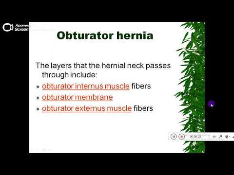 Quiz powerpoint video - case 168 - Refresh your knowledge