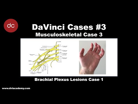 Brachial Plexus Case 1 [#DaVinciCases Musculoskeletal 3]