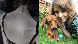 &quot;My dog saved me from anorexia&quot;