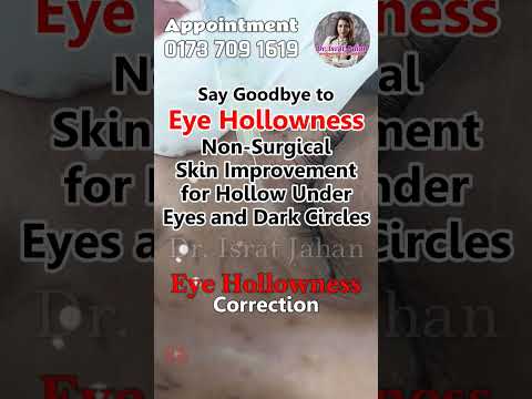 Under eye dermal filler - Dr. Israt Jahan