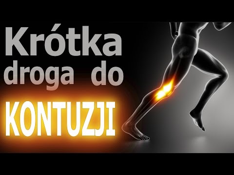 Opinie koślawego ustalających Koślawego pro kupić w Niżnym Nowogrodzie