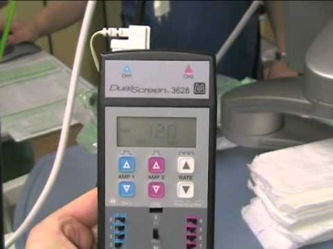 Neurostimulators Implantation - Abdominal/Buttock Positioning