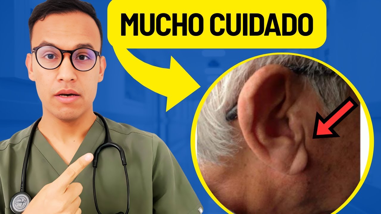 CUIDADO si tu oreja se ve así
