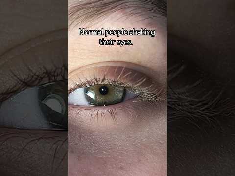 I think I have voluntary nystagmus #eye #trend #rare