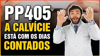 PP405: A CALVÍCIE ESTÁ COM OS DIAS CONTADOS