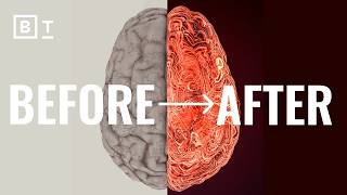The most important thing you can do for your brain isn't mental