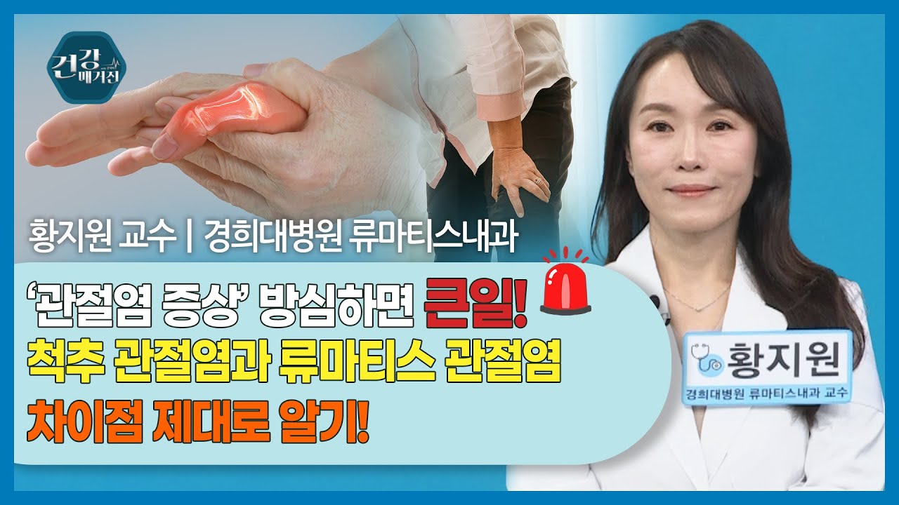 [#건강앤한경] 30대와 40대에서도 발생하는 류마티스 관절염과 척추 관절염/관절 붓고 아픈 증상, 뻣뻣한 ?