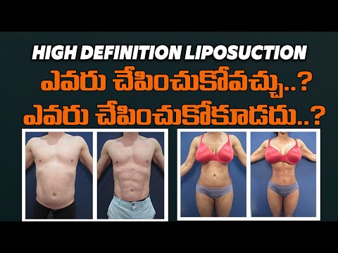High Definition Liposuction: Benefits, Process, and Results | Dr. Dushyanth Kalva | Inform Clinic