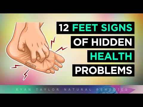 These Common Foot Issues Could Indicate Poor Health