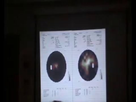 2011 Retinitis Pigmentosa Association - Holland Part2