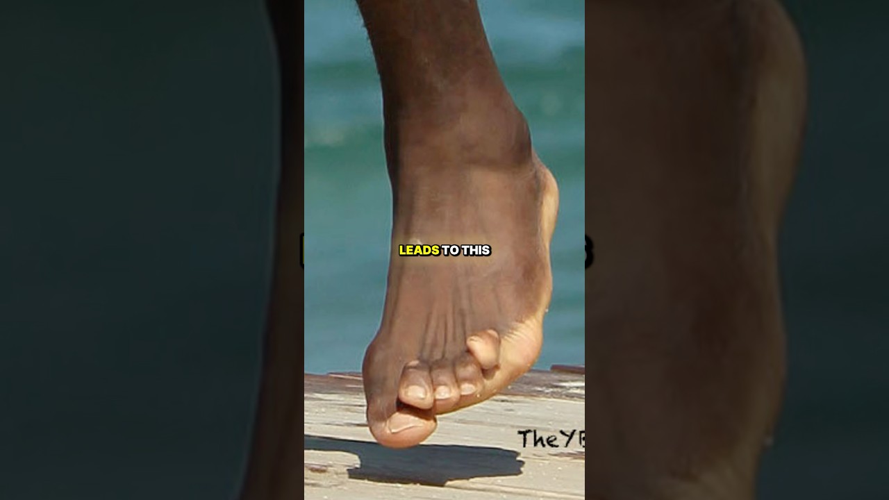 Why do NBA players have weird feet 🤯