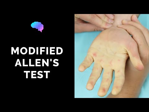 Modifizierter Allen-Test