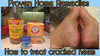 How To Use Apple Cider Vinegar and Baking Soda As A Treatment For Calluses and Cracked Heels