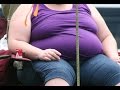 Is Morbid Obesity 'Beautiful'? 