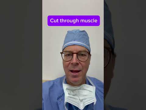 Learn the steps that a Brain surgeon uses to expose the human brain #doctor #interestingfacts #short