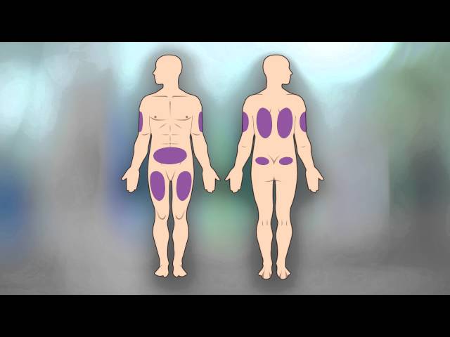 Video pronuncia di subcutaneous in Inglese