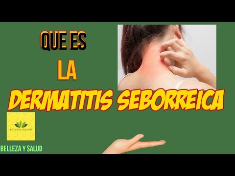 Gistan las revocaciones a atopicheskom la dermatitis La psoriasis alcohólica los síntomas