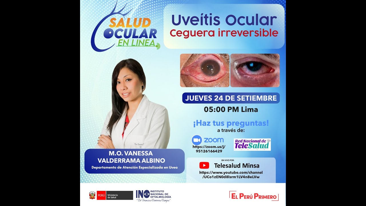 UVEITIS OCULAR: CEGUERA  IRREVERSIBLE