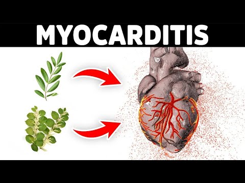 Shingles Natural Relief