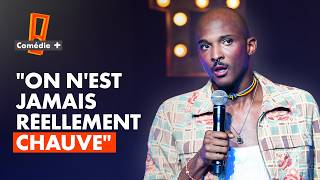 Noam Sinseau : "On n'est jamais réellement chauve" - Comédie+