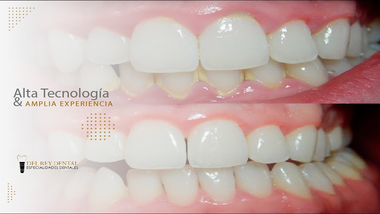 Alejandro Rodríguez Del Rey Rodríguez-8