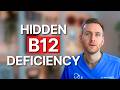 11 Symptoms Of Dangerous B12 Deficiency Even If Tests Say You Re Fine