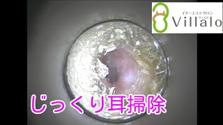耳掃除動画vol.61「じっくり耳掃除 2倍速推奨」