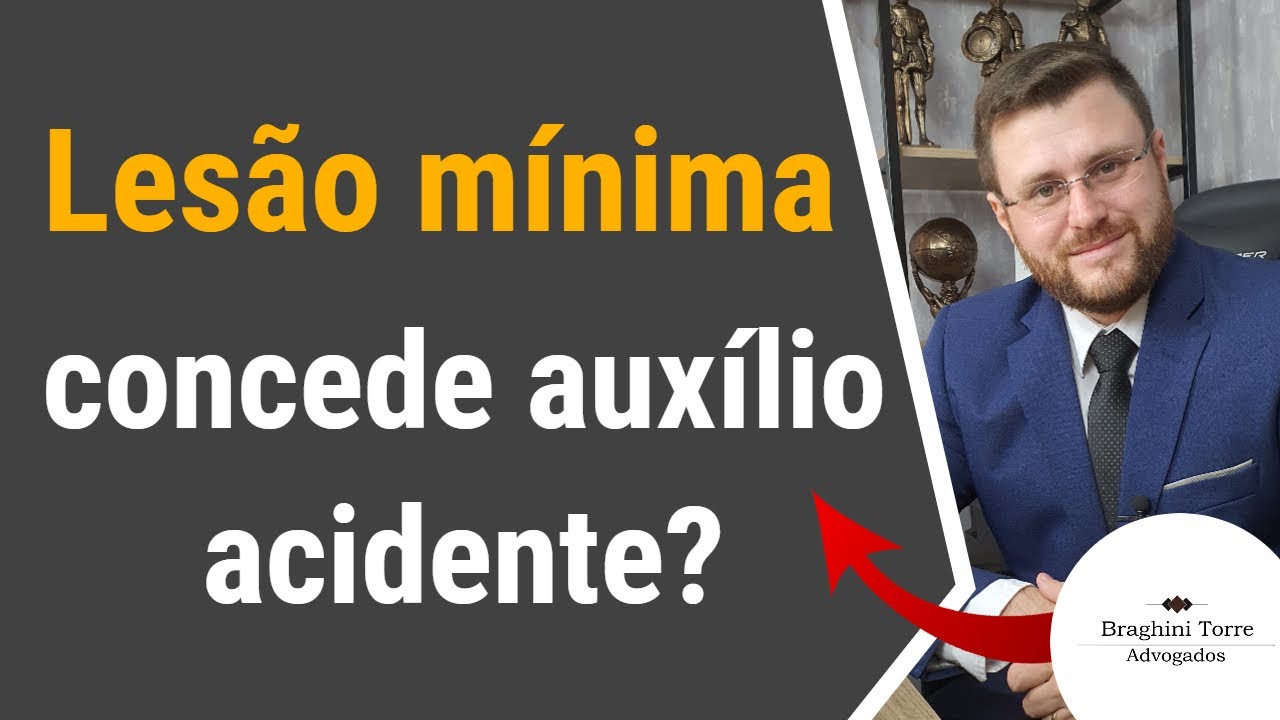Lesão mínima concede auxílio acidente?