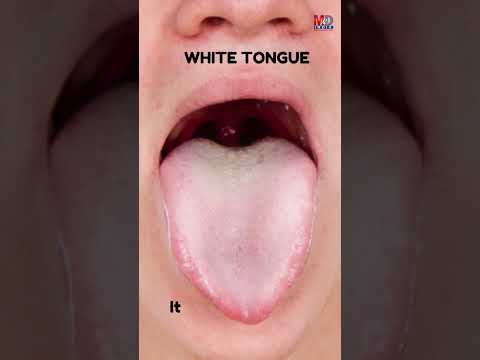 AI-Powered Tongue Diagnosis: A Modern Twist on an Ancient Practice