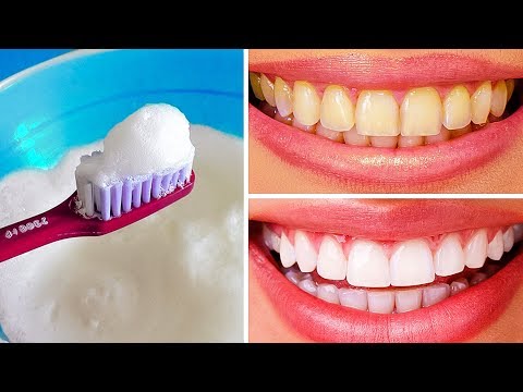 10 Modi Naturali per Sbiancare i Denti a Casa
