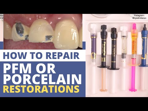 How to Repair PFM/Porcelain Restorations
