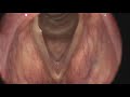 Vocal Folds Pitch Physics Demo