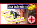 Ear Infections: Best Ways to Treat at Home and Prevent that Earache